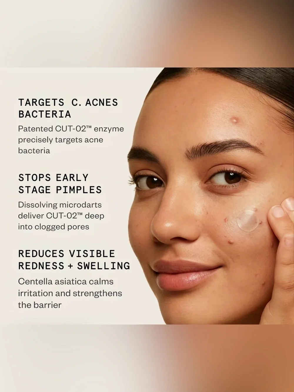 Hypothesis Bio Precision Microdart Acne Patches